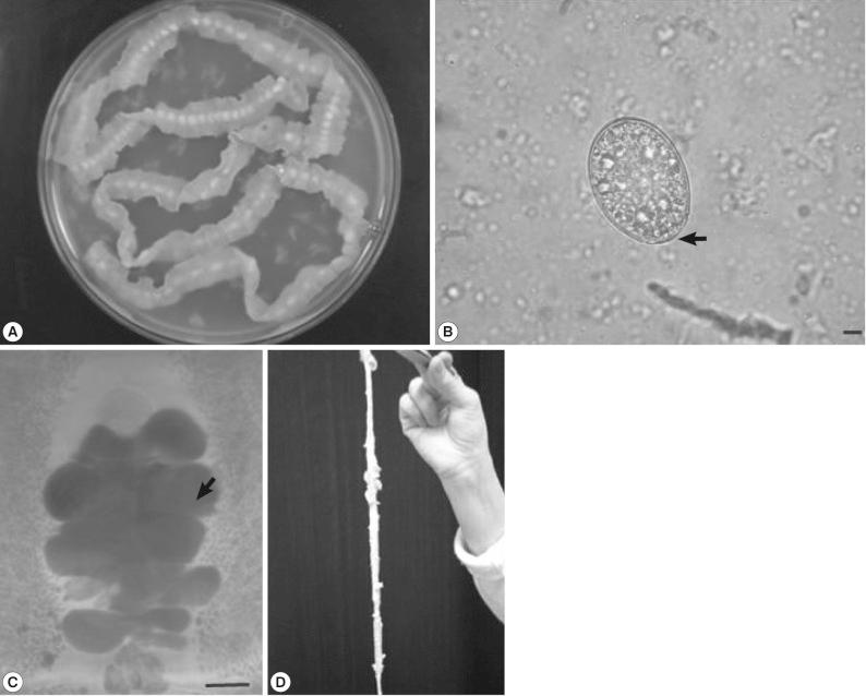 https://cdn.ncbi.nlm.nih.gov/pmc/blobs/d291/3375453/eb050ec75caf/kjp-50-143-g001.jpg