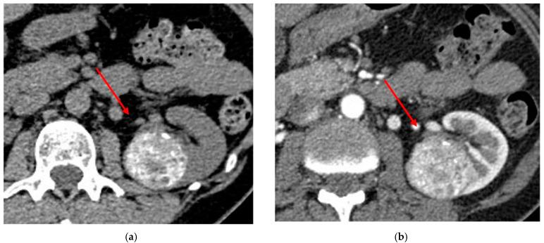 https://cdn.ncbi.nlm.nih.gov/pmc/blobs/d297/9914376/0a86caa20f03/diagnostics-13-00334-g006.jpg