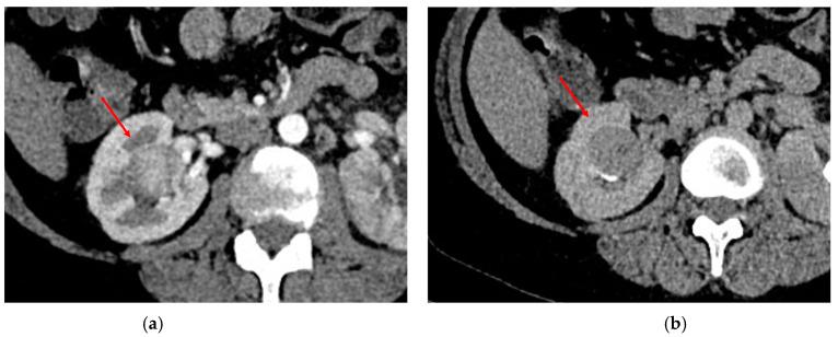https://cdn.ncbi.nlm.nih.gov/pmc/blobs/d297/9914376/0cd663687ee9/diagnostics-13-00334-g003.jpg