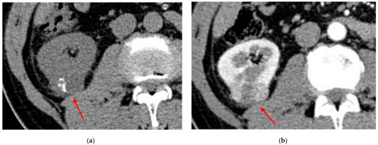 https://cdn.ncbi.nlm.nih.gov/pmc/blobs/d297/9914376/326fd3893724/diagnostics-13-00334-g007.jpg