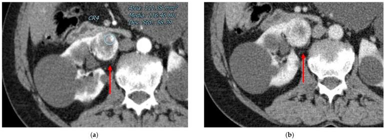 https://cdn.ncbi.nlm.nih.gov/pmc/blobs/d297/9914376/38e49bdb6ce8/diagnostics-13-00334-g002.jpg