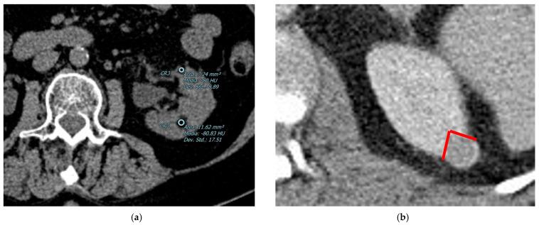 https://cdn.ncbi.nlm.nih.gov/pmc/blobs/d297/9914376/7c8e14209fe9/diagnostics-13-00334-g001.jpg