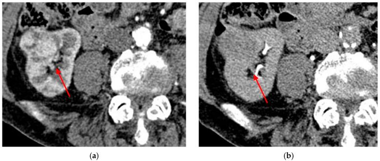 https://cdn.ncbi.nlm.nih.gov/pmc/blobs/d297/9914376/fae6e2aa5dcf/diagnostics-13-00334-g004.jpg