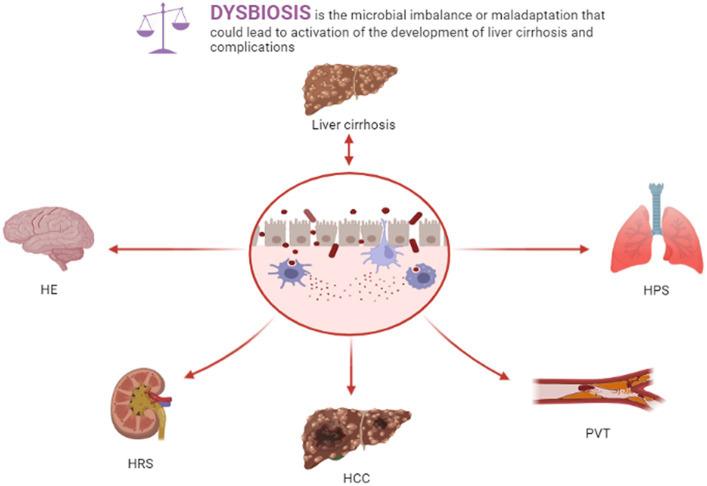 https://cdn.ncbi.nlm.nih.gov/pmc/blobs/d29b/10824916/4c3d636abccc/fmed-10-1320015-g001.jpg