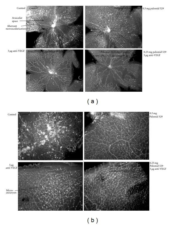 https://cdn.ncbi.nlm.nih.gov/pmc/blobs/d2a2/3205601/d6bc8d2a69d7/JOP2011-589813.002.jpg