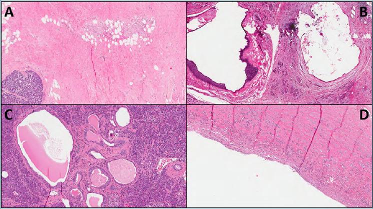 https://cdn.ncbi.nlm.nih.gov/pmc/blobs/d2a4/7931580/113927e05671/pathol-2020-03-197-g002.jpg