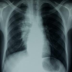 https://cdn.ncbi.nlm.nih.gov/pmc/blobs/d2a5/5567944/b1cea4232147/PAMJ-27-149-g002.jpg