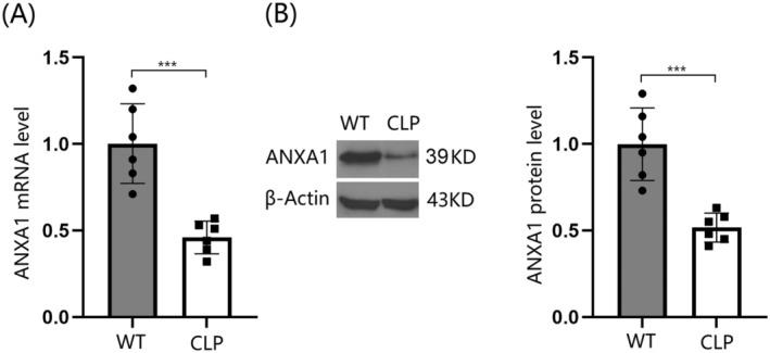 https://cdn.ncbi.nlm.nih.gov/pmc/blobs/d2aa/11672249/96480b866d7e/CNS-30-e70173-g008.jpg