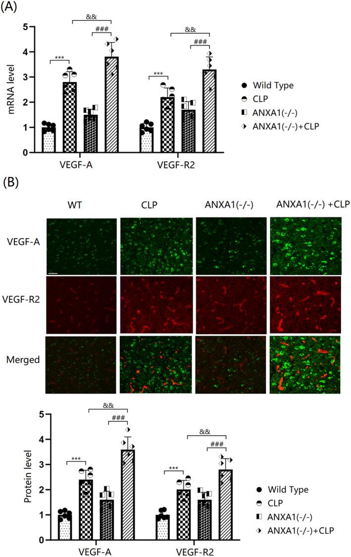 https://cdn.ncbi.nlm.nih.gov/pmc/blobs/d2aa/11672249/d2339763a684/CNS-30-e70173-g010.jpg