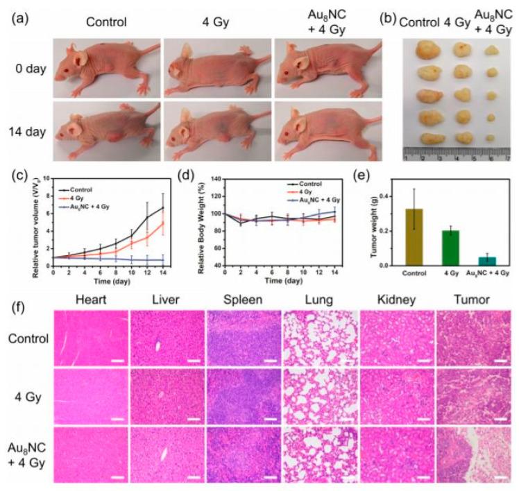 https://cdn.ncbi.nlm.nih.gov/pmc/blobs/d2af/8833418/d6515b84b67b/cancers-14-00514-g005.jpg