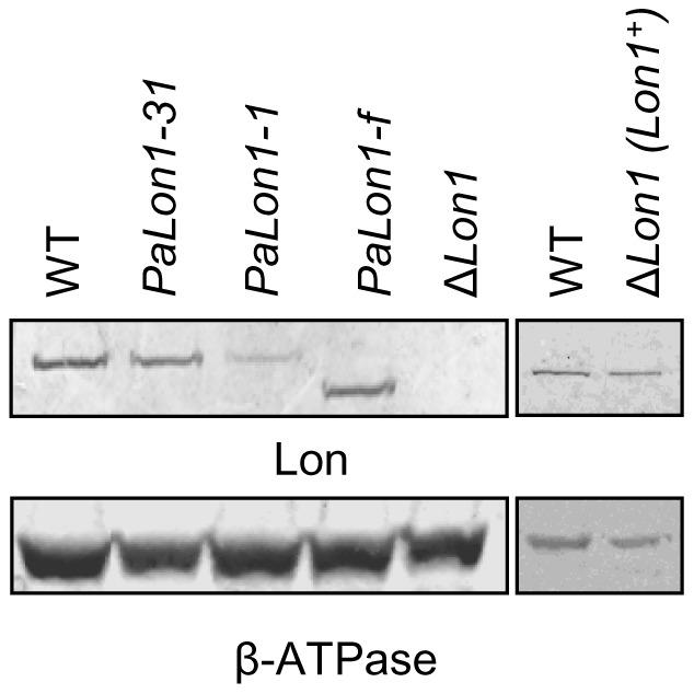 https://cdn.ncbi.nlm.nih.gov/pmc/blobs/d2b2/3364969/03e95ac9647f/pone.0038138.g004.jpg