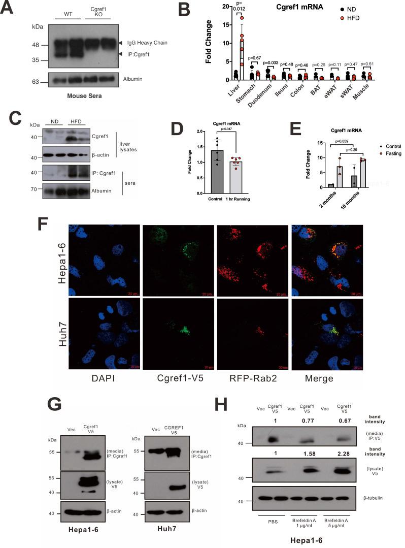 https://cdn.ncbi.nlm.nih.gov/pmc/blobs/d2bb/12035884/4f23873cb99b/ijbsv21p2568g002.jpg