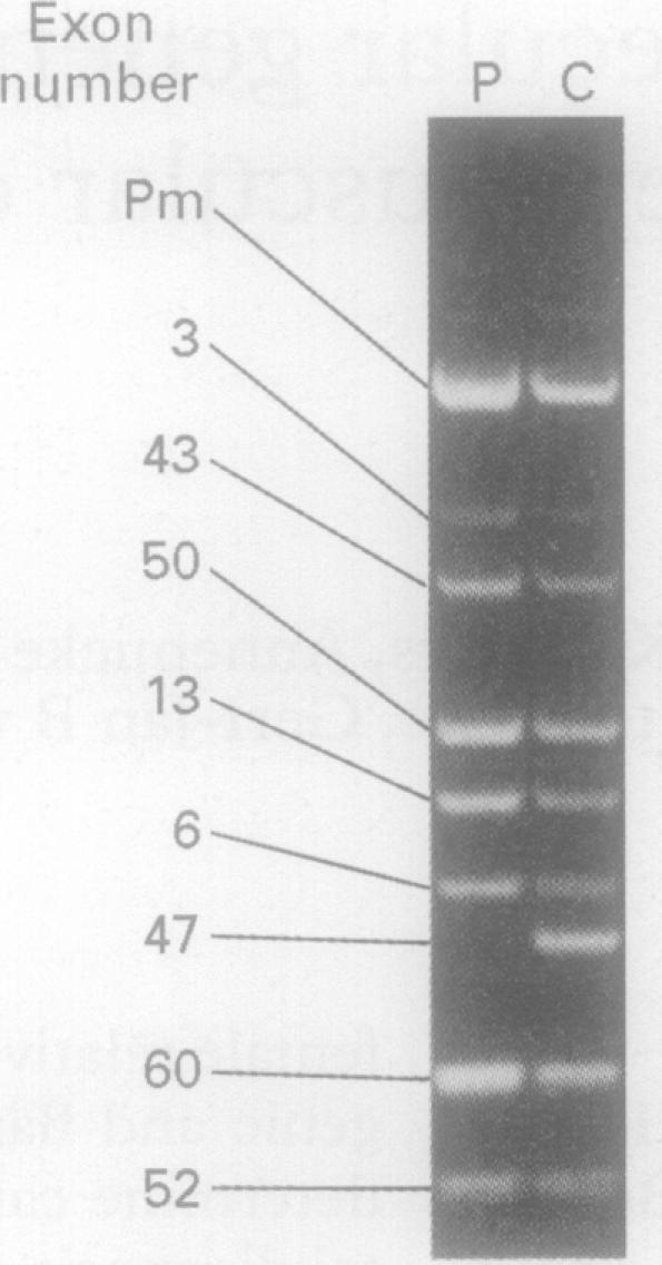https://cdn.ncbi.nlm.nih.gov/pmc/blobs/d2c1/1051085/30ae76f95c22/jmedgene00252-0014-a.jpg
