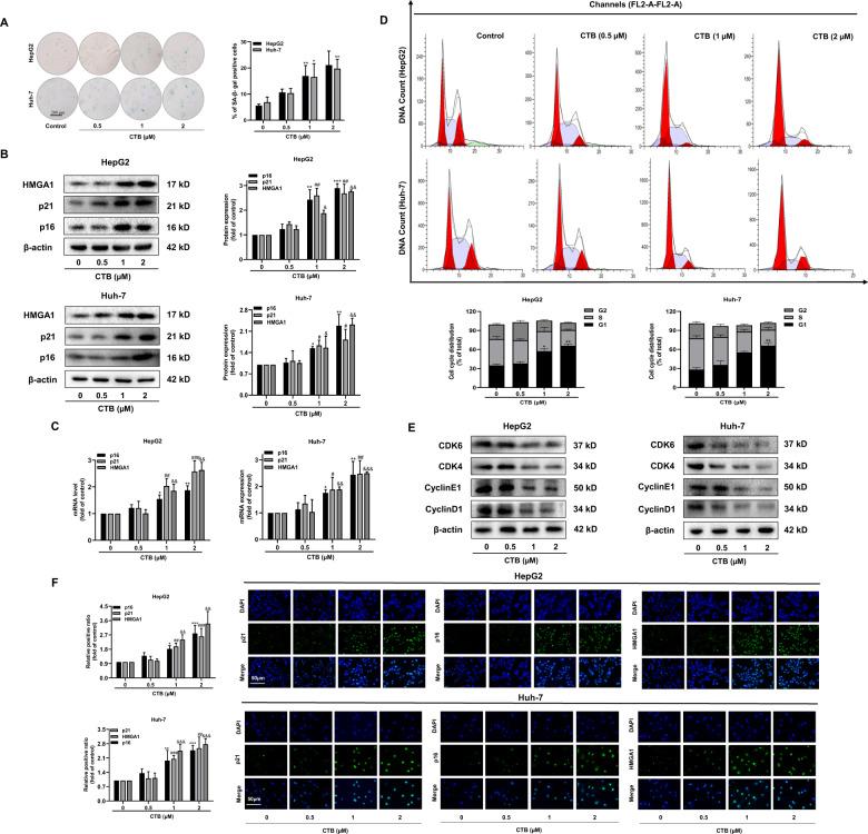 https://cdn.ncbi.nlm.nih.gov/pmc/blobs/d2c4/7548283/e016e648fd19/41419_2020_3048_Fig1_HTML.jpg