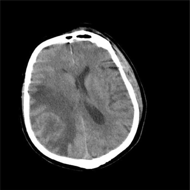 https://cdn.ncbi.nlm.nih.gov/pmc/blobs/d2c5/8718809/91aca3546bd6/gr1.jpg