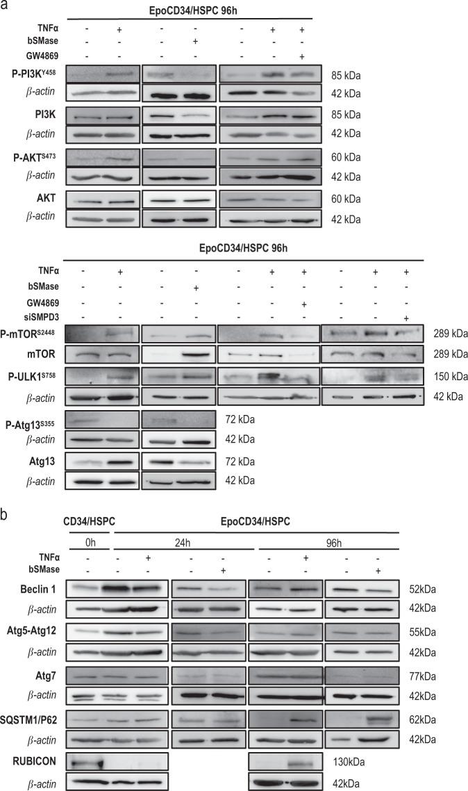 https://cdn.ncbi.nlm.nih.gov/pmc/blobs/d2cb/6748125/5f39570e0d91/41418_2018_245_Fig4_HTML.jpg