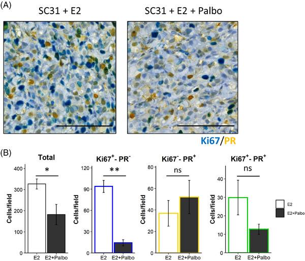 https://cdn.ncbi.nlm.nih.gov/pmc/blobs/d2ce/10823285/07fc81c74cf9/CTM2-14-e1548-g002.jpg