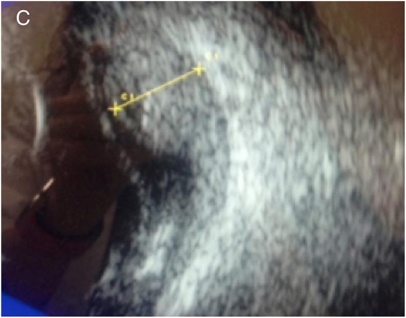 https://cdn.ncbi.nlm.nih.gov/pmc/blobs/d2ce/6599871/45aa72e83459/gr2.jpg