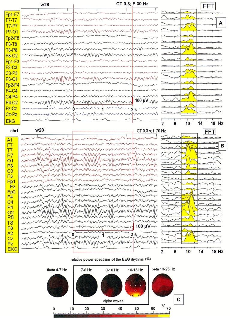https://cdn.ncbi.nlm.nih.gov/pmc/blobs/d2d8/5601034/e68b56ca7c2e/fnins-11-00506-g0002.jpg