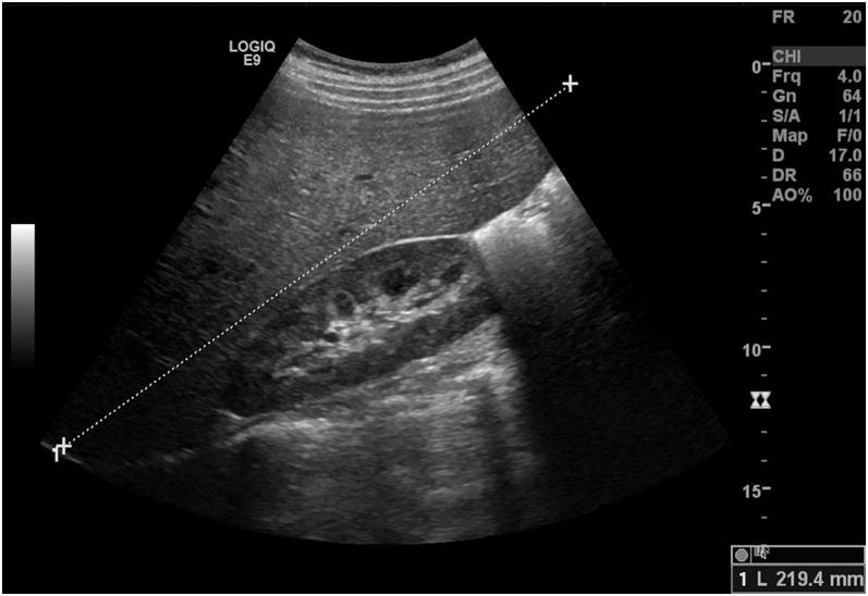 https://cdn.ncbi.nlm.nih.gov/pmc/blobs/d2e0/12326969/f0948ea8cb8c/EDM-25-0035fig1.jpg