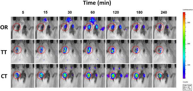 https://cdn.ncbi.nlm.nih.gov/pmc/blobs/d2e0/8420880/797a8cc35c8f/fneur-12-641593-g0001.jpg