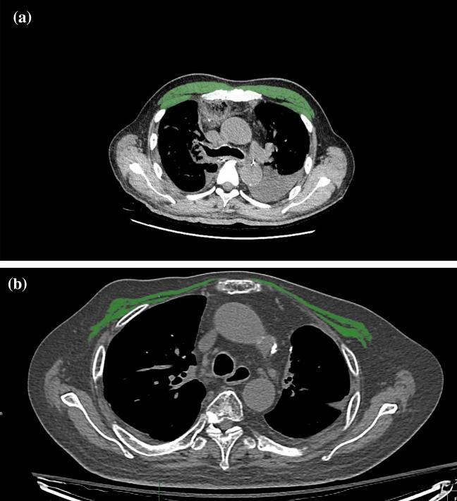 https://cdn.ncbi.nlm.nih.gov/pmc/blobs/d2e1/8648749/fedd463d27ae/41598_2021_2853_Fig2_HTML.jpg