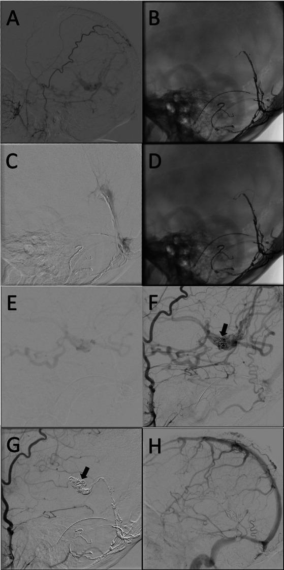 https://cdn.ncbi.nlm.nih.gov/pmc/blobs/d2e2/10126350/cd461543c94d/fneur-14-1128563-g003.jpg