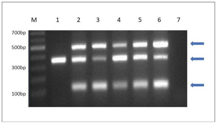 https://cdn.ncbi.nlm.nih.gov/pmc/blobs/d2e7/6352075/7c90b596905f/microorganisms-07-00003-g005.jpg