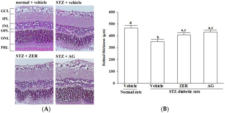 https://cdn.ncbi.nlm.nih.gov/pmc/blobs/d2ec/4997364/5715de64af42/nutrients-08-00449-g001.jpg