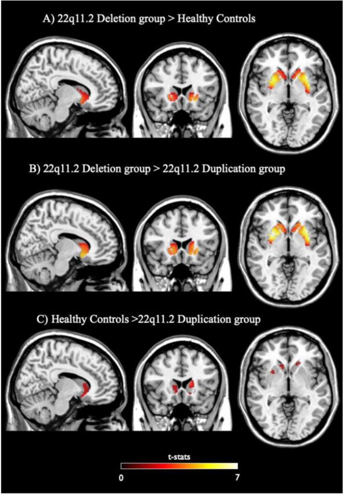 https://cdn.ncbi.nlm.nih.gov/pmc/blobs/d2f0/10575769/fd530741ad67/41380_2021_1108_Fig3_HTML.jpg