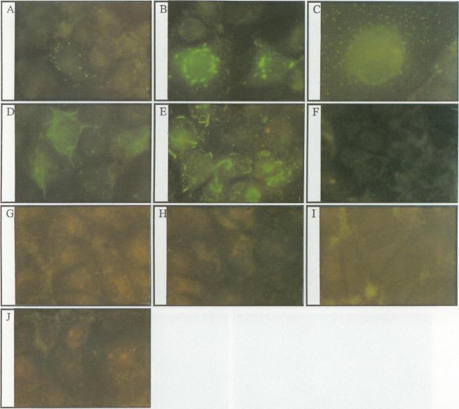 https://cdn.ncbi.nlm.nih.gov/pmc/blobs/d2f3/236935/bfaf612ce888/jvirol00018-0037-a.jpg