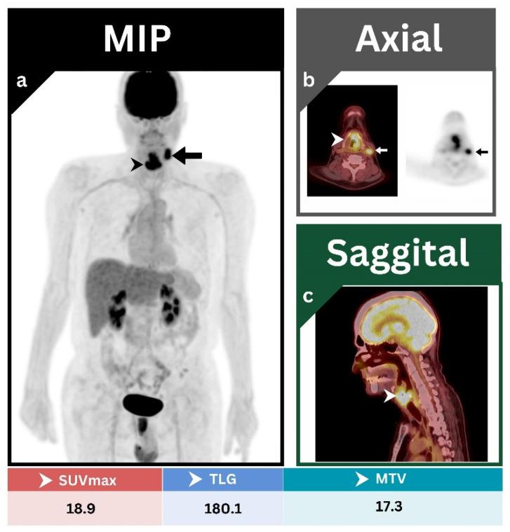 https://cdn.ncbi.nlm.nih.gov/pmc/blobs/d2f7/10218884/5ad6b23342d2/jcm-12-03514-g001.jpg