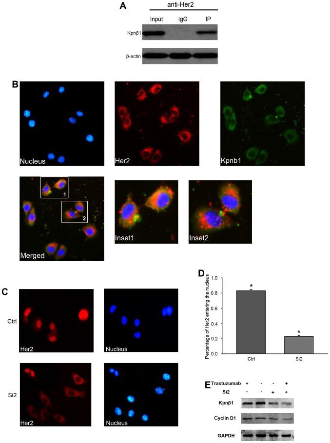 https://cdn.ncbi.nlm.nih.gov/pmc/blobs/d2fe/5783623/95a1cb894473/OR-39-02-0554-g05.jpg