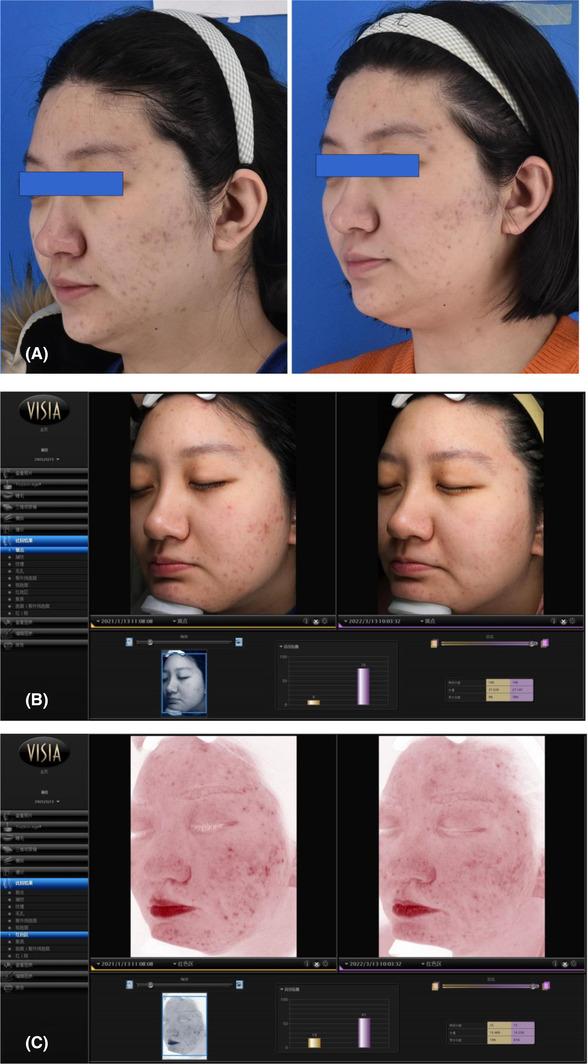 https://cdn.ncbi.nlm.nih.gov/pmc/blobs/d305/10155796/30f4ea23b138/SRT-29-e13274-g005.jpg