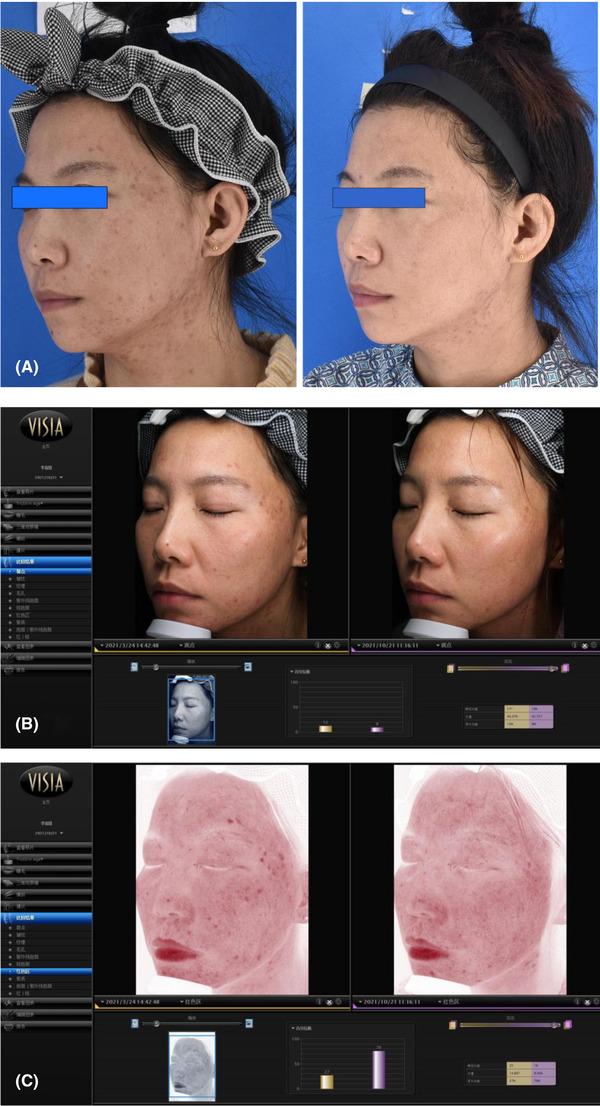https://cdn.ncbi.nlm.nih.gov/pmc/blobs/d305/10155796/40db7c4c92d9/SRT-29-e13274-g003.jpg