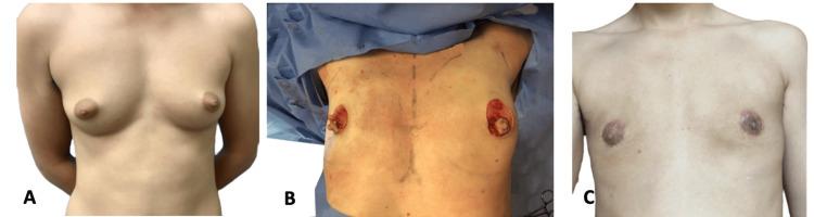 https://cdn.ncbi.nlm.nih.gov/pmc/blobs/d308/12004420/b6787d05d623/cureus-0017-00000080757-i02.jpg