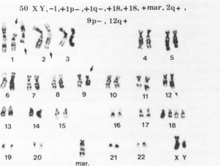 https://cdn.ncbi.nlm.nih.gov/pmc/blobs/d309/2247067/9377986d4045/brjcancer00125-0039-a.jpg