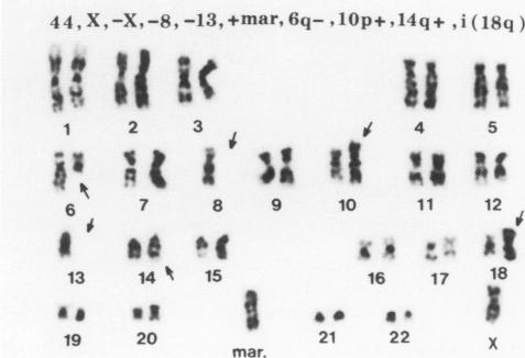 https://cdn.ncbi.nlm.nih.gov/pmc/blobs/d309/2247067/cab3ff6216fb/brjcancer00125-0039-c.jpg