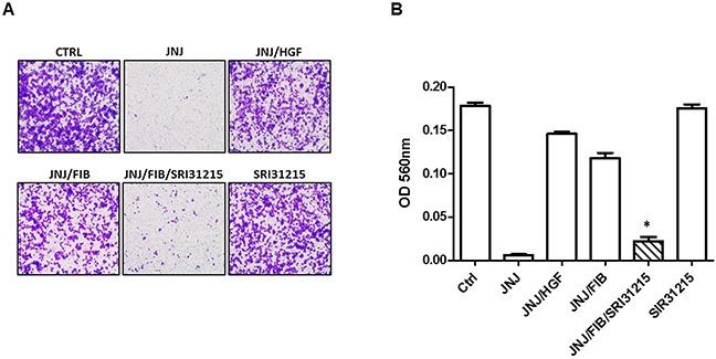 https://cdn.ncbi.nlm.nih.gov/pmc/blobs/d30b/5609899/eb9f33765c54/oncotarget-08-63014-g004.jpg