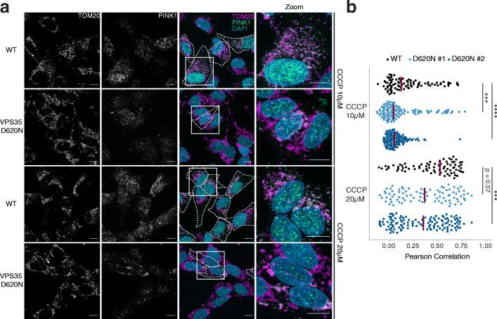 https://cdn.ncbi.nlm.nih.gov/pmc/blobs/d30c/8204421/d852b74fc090/40035_2021_243_Fig3_HTML.jpg