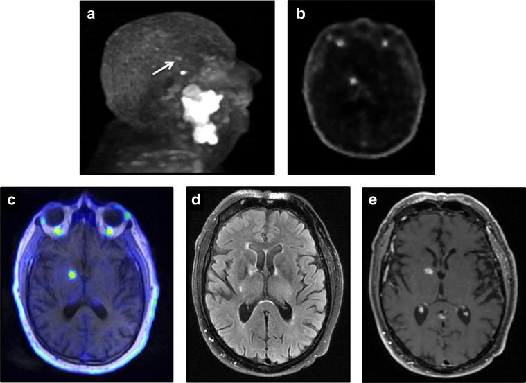 https://cdn.ncbi.nlm.nih.gov/pmc/blobs/d30d/6823742/1f286b54f5b4/gr1.jpg