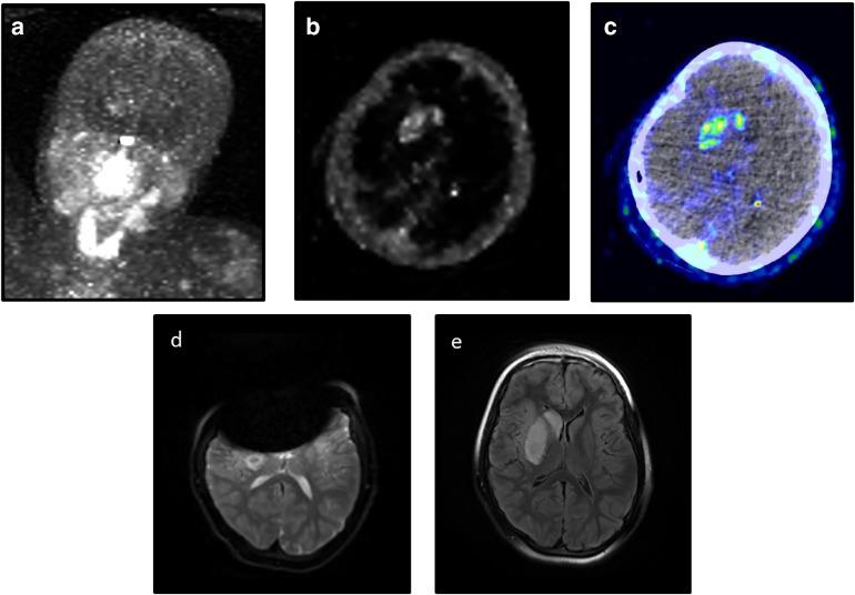 https://cdn.ncbi.nlm.nih.gov/pmc/blobs/d30d/6823742/64b652b19ac7/gr2.jpg