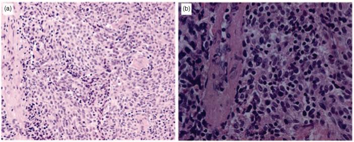 https://cdn.ncbi.nlm.nih.gov/pmc/blobs/d311/9791293/0a8db6a7ba0f/10.1177_03000605221142401-fig3.jpg