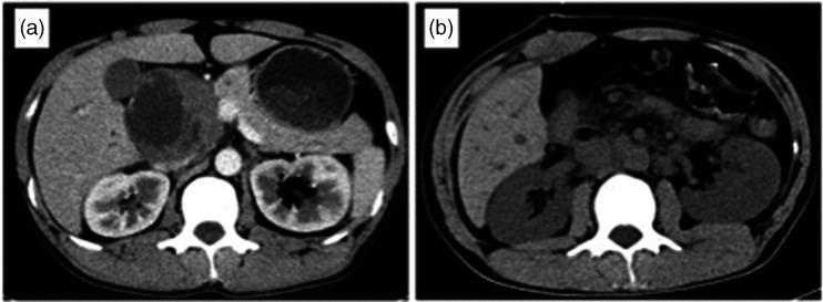 https://cdn.ncbi.nlm.nih.gov/pmc/blobs/d311/9791293/c28abb2a5669/10.1177_03000605221142401-fig1.jpg