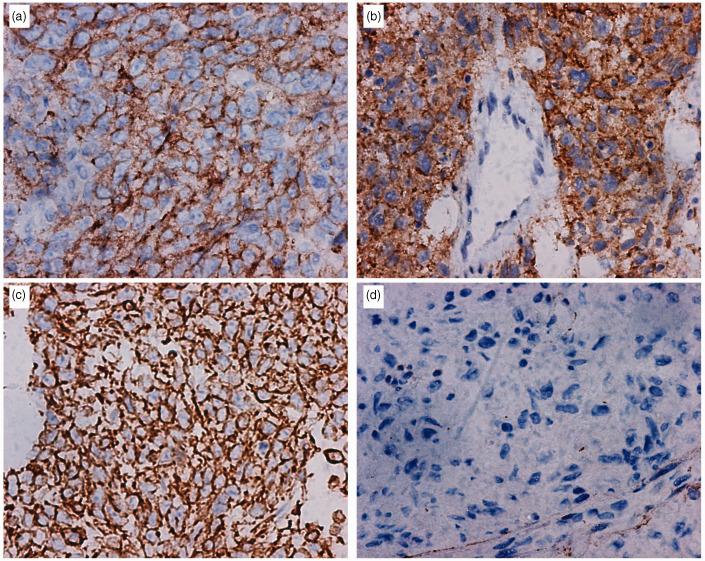 https://cdn.ncbi.nlm.nih.gov/pmc/blobs/d311/9791293/f440a1e6a551/10.1177_03000605221142401-fig4.jpg