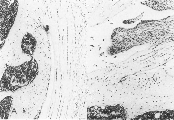 https://cdn.ncbi.nlm.nih.gov/pmc/blobs/d31b/1916019/56662a1fc062/amjpathol00202-0019-b.jpg