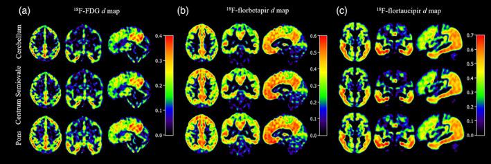 https://cdn.ncbi.nlm.nih.gov/pmc/blobs/d31c/8996354/285ca86f9a31/HBM-43-2121-g003.jpg