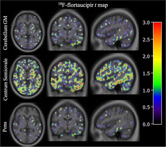 https://cdn.ncbi.nlm.nih.gov/pmc/blobs/d31c/8996354/6725dd58a93e/HBM-43-2121-g002.jpg