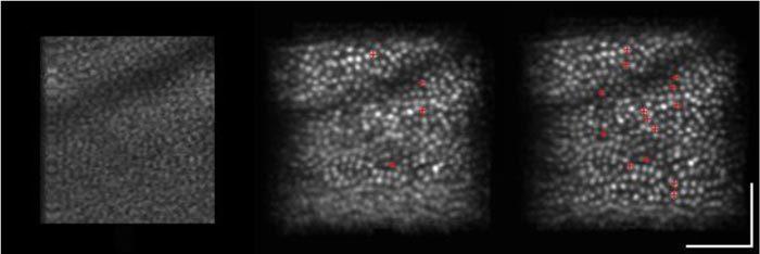 https://cdn.ncbi.nlm.nih.gov/pmc/blobs/d31d/3072118/c0b03f5f4ada/boe-2-4-748-g006.jpg