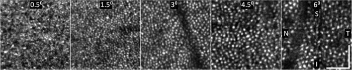 https://cdn.ncbi.nlm.nih.gov/pmc/blobs/d31d/3072118/dae217854575/boe-2-4-748-g003.jpg